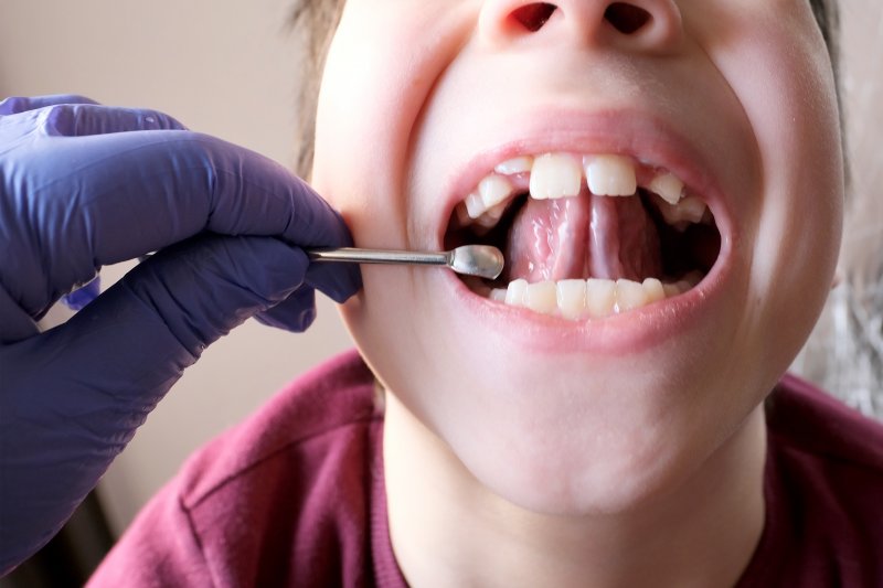 doctor examining underneath a child’s tongue